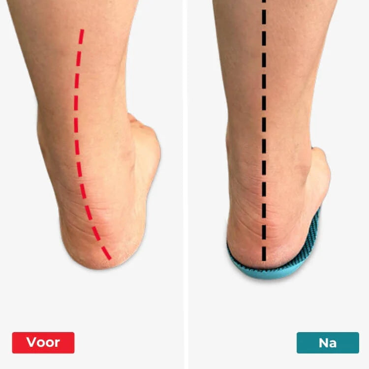 ProStep™ Een hele dag staan en lopen zonder pijn