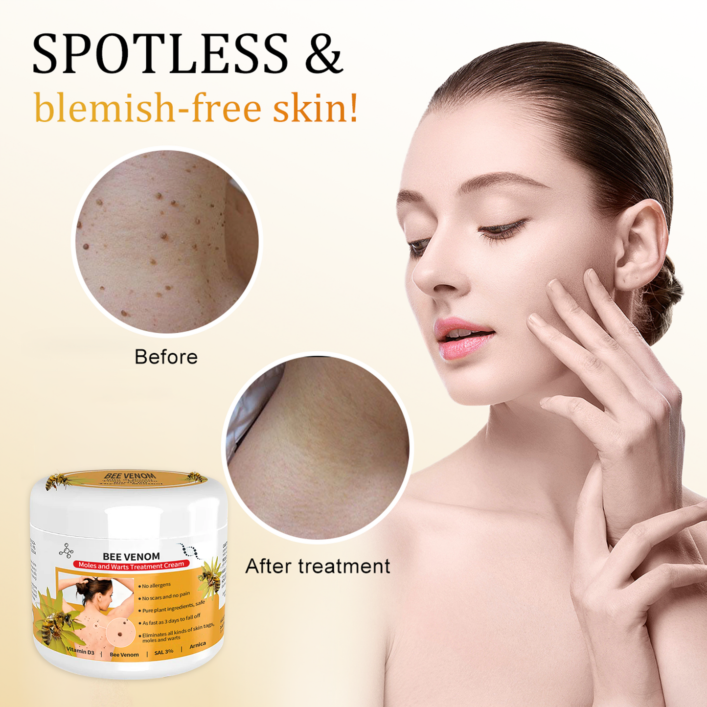 SkinRevive Bee Venom | Moedervlek- en Wratbehandelingcrème