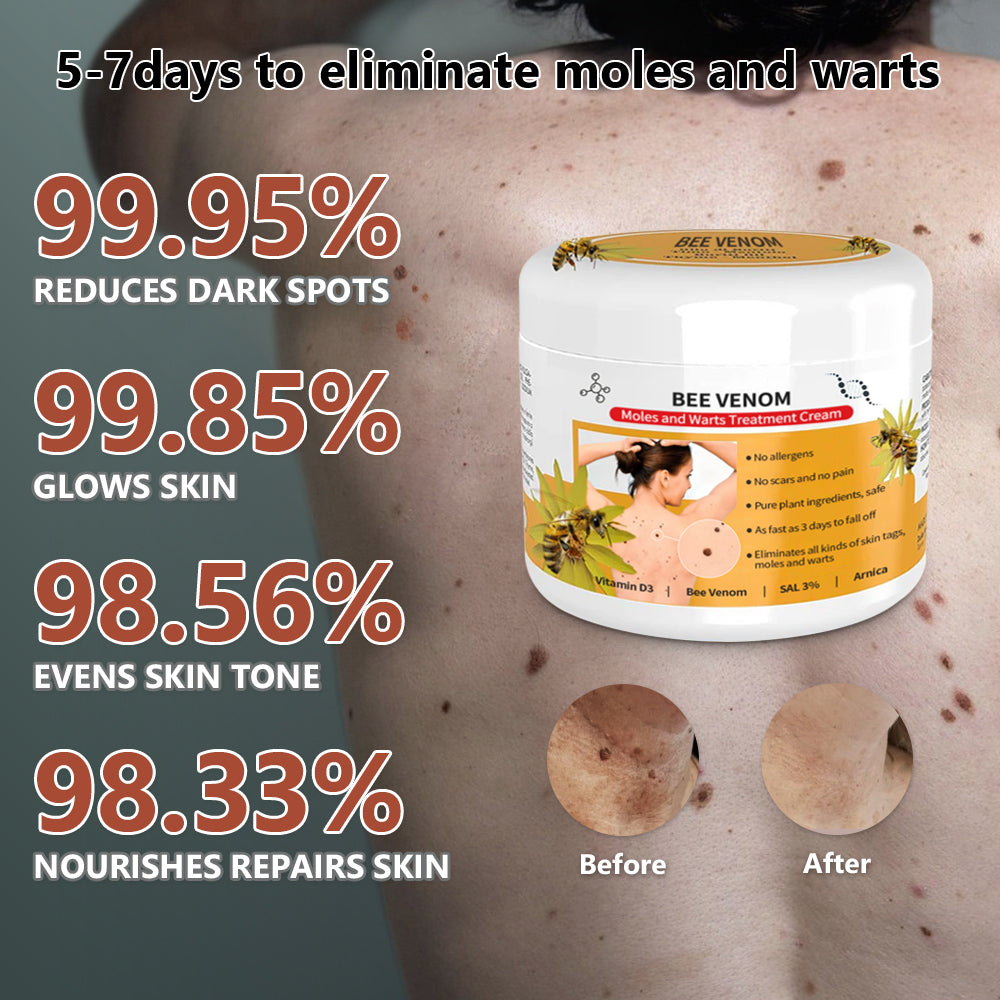 SkinRevive Bee Venom | Moedervlek- en Wratbehandelingcrème