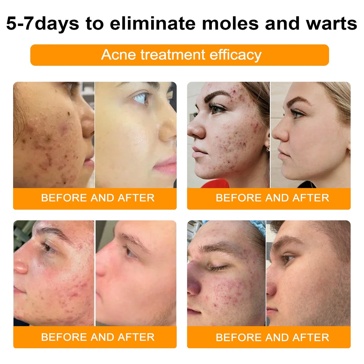 SkinRevive Bee Venom | Moedervlek- en Wratbehandelingcrème