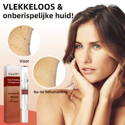 WipeOff Clean™ | Moedervlek en Wratten verwijderaar | 1 + 1 GRATIS
