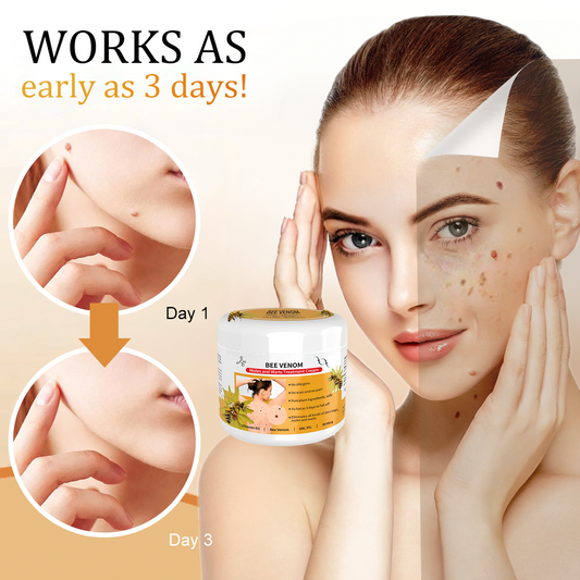 SkinRevive Bee Venom | Moedervlek- en Wratbehandelingcrème