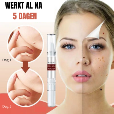 WipeOff Clean™ | Moedervlek en Wratten verwijderaar | 1 + 1 GRATIS
